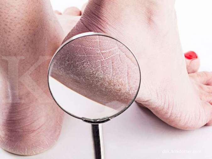 Best way to get rid of dry skin on feet