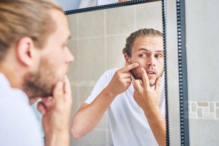 beard acne