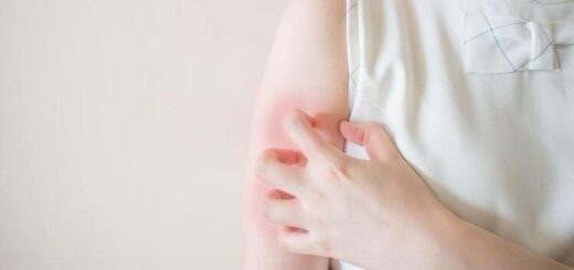 What is good for itching due to stress