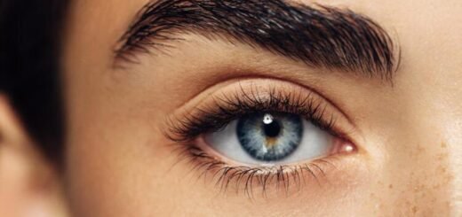 home remedies for under-eye bruises