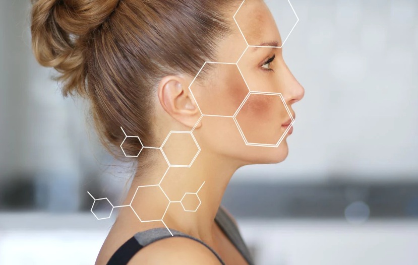 Dark spots on the face