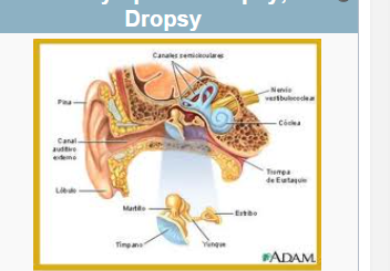 Endolymphatic dropsy